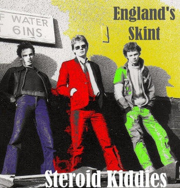 Steroid Kiddies, - England's Skint
